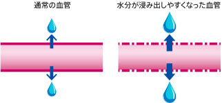 血管性浮腫の原因となる血管の変化