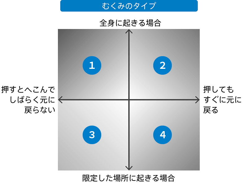 むくみに隠れるこんな病気